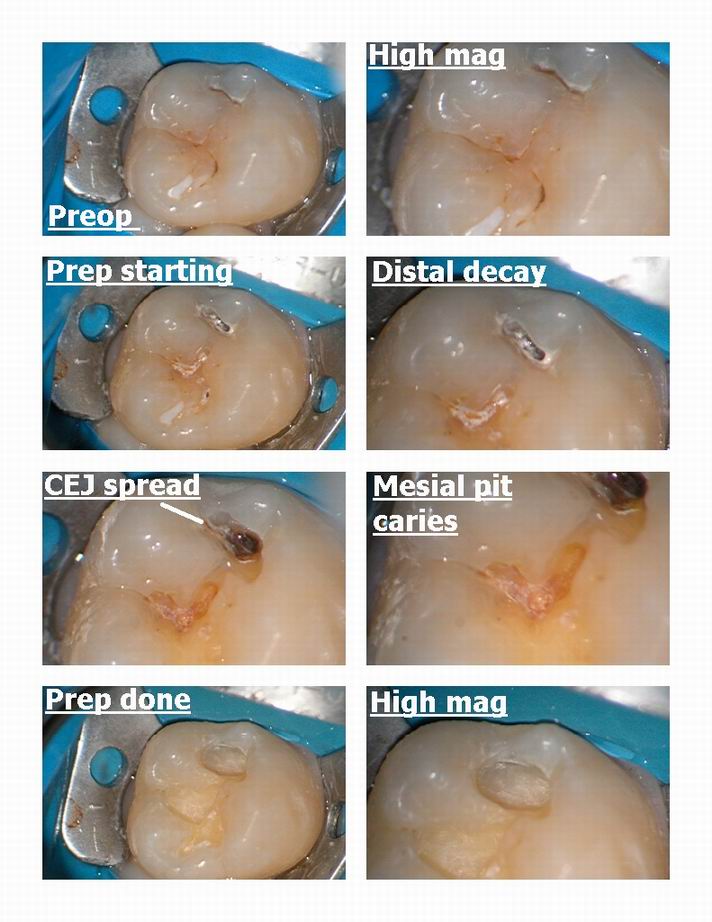 Resize of Class 1 with burs pg 1.jpg